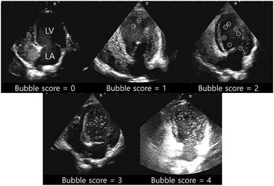 Evaluation of intrapulmonary arteriovenous anastomoses before and after oxygen supplementation, using transthoracic agitated saline contrast echocardiography in rescued Korean raccoon dogs